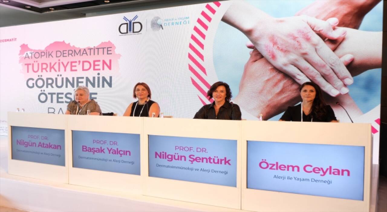 Türkiye’de ilk kez yapılan ”atopik dermatit” araştırmasının sonuçları paylaşıldı