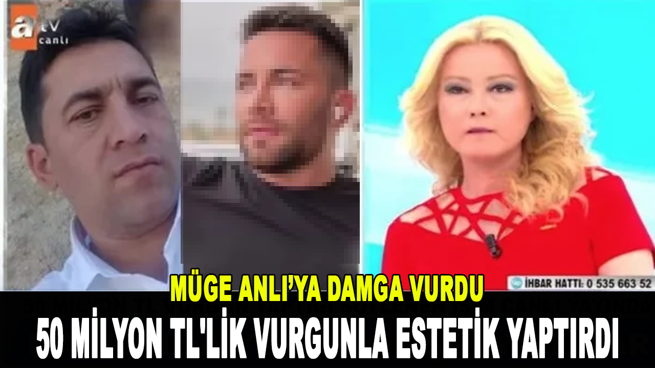 50 milyon TL'lik vurgun yapan kişi estetikle bu hale geldi