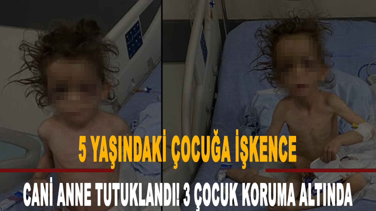 Annesi tarafından işkenceye maruz kalan 5 yaşındaki çocuk yaşam savaşı veriyor