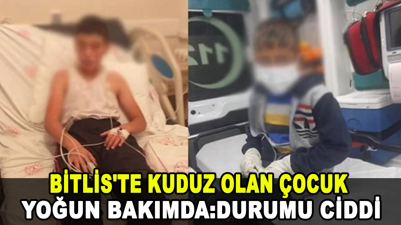 Bitlis'te kuduz olan çocuk yoğun bakımda: Durumu ciddi