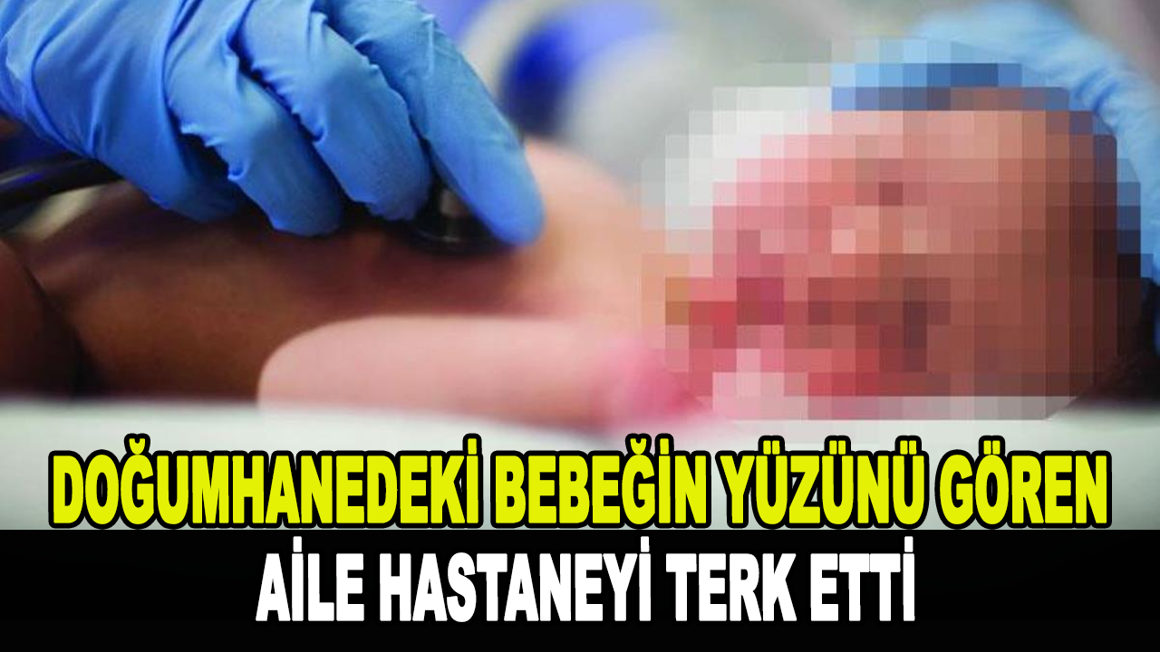 Doğumhanedeki bebeğin yüzünü gören aile hastaneyi terk etti