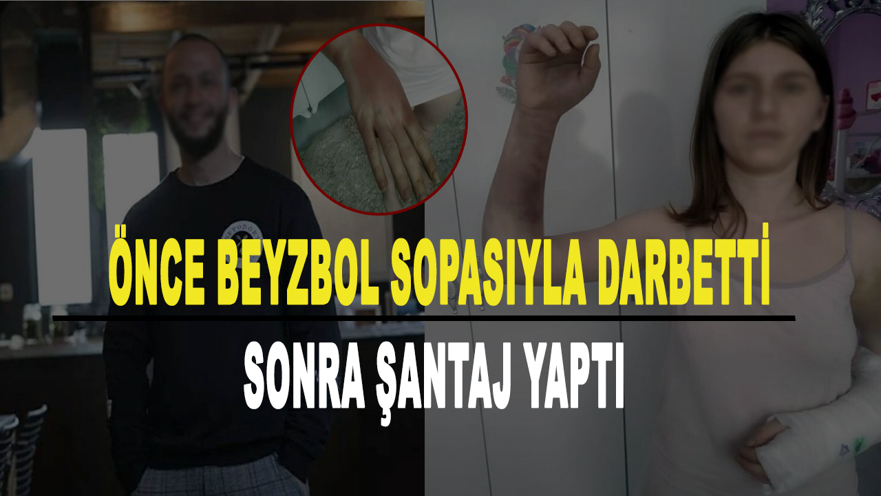 İzmir’de sevgili dehşeti! Önce beyzbol sopasıyla darbetti sonra şantaj yaptı