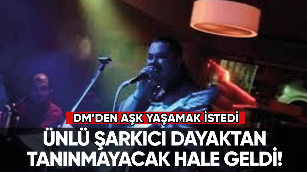 Ünlü şarkıcı dayaktan tanınmayacak hale geldi!