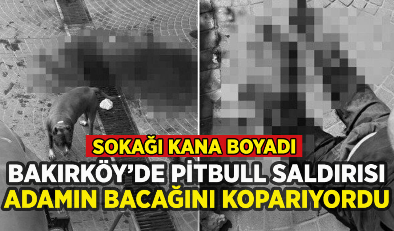 Bakırköy'de pitbull saldırısı: Bacağını parçaladı