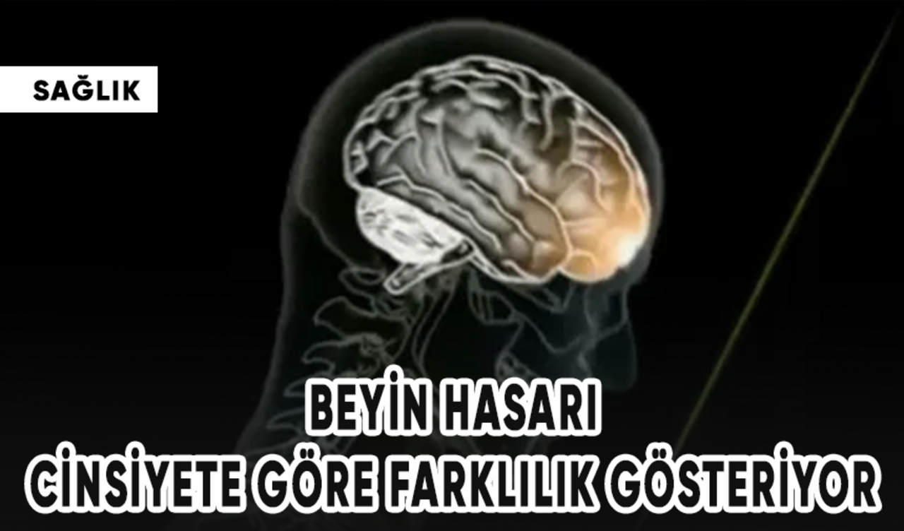 Beyin hasarı cinsiyete göre farklılık gösteriyor