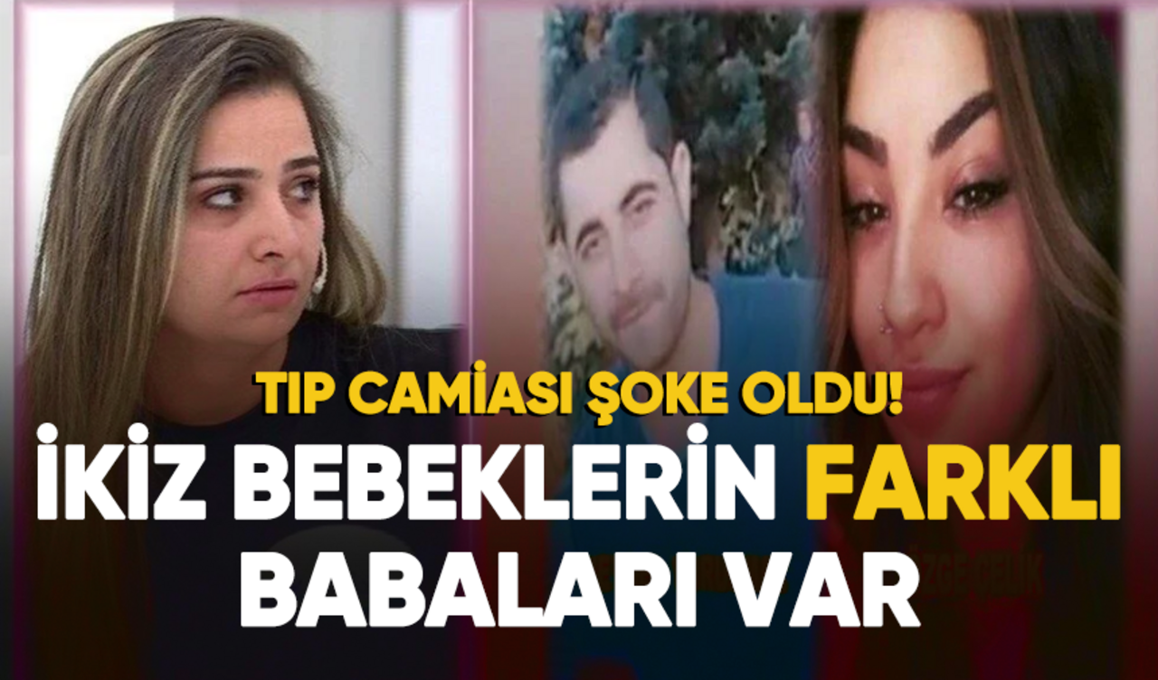 Tıp camiası şoke oldu! İkiz bebeklerin babaları farklı çıktı