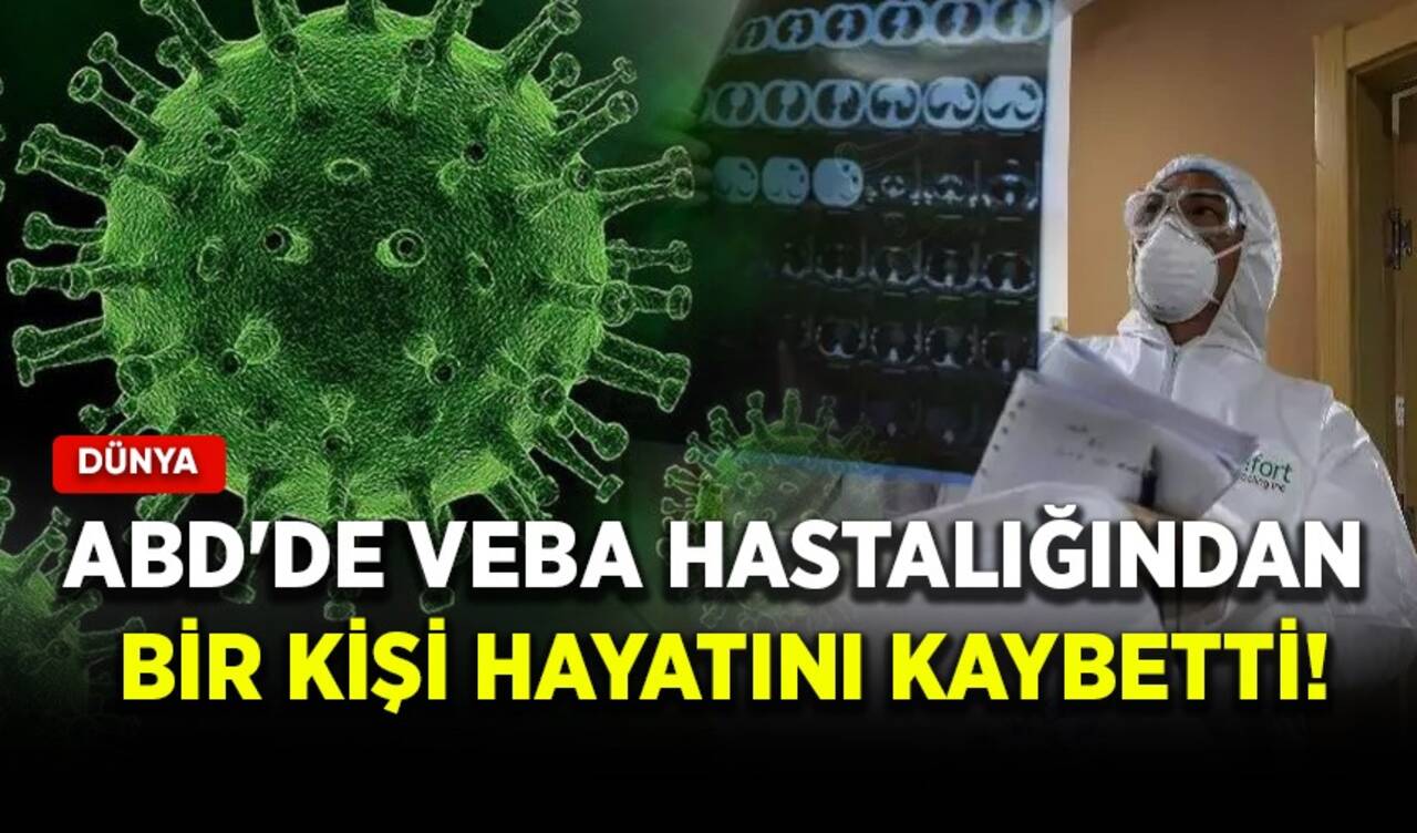 ABD'de veba hastalığından bir kişi hayatını kaybetti!