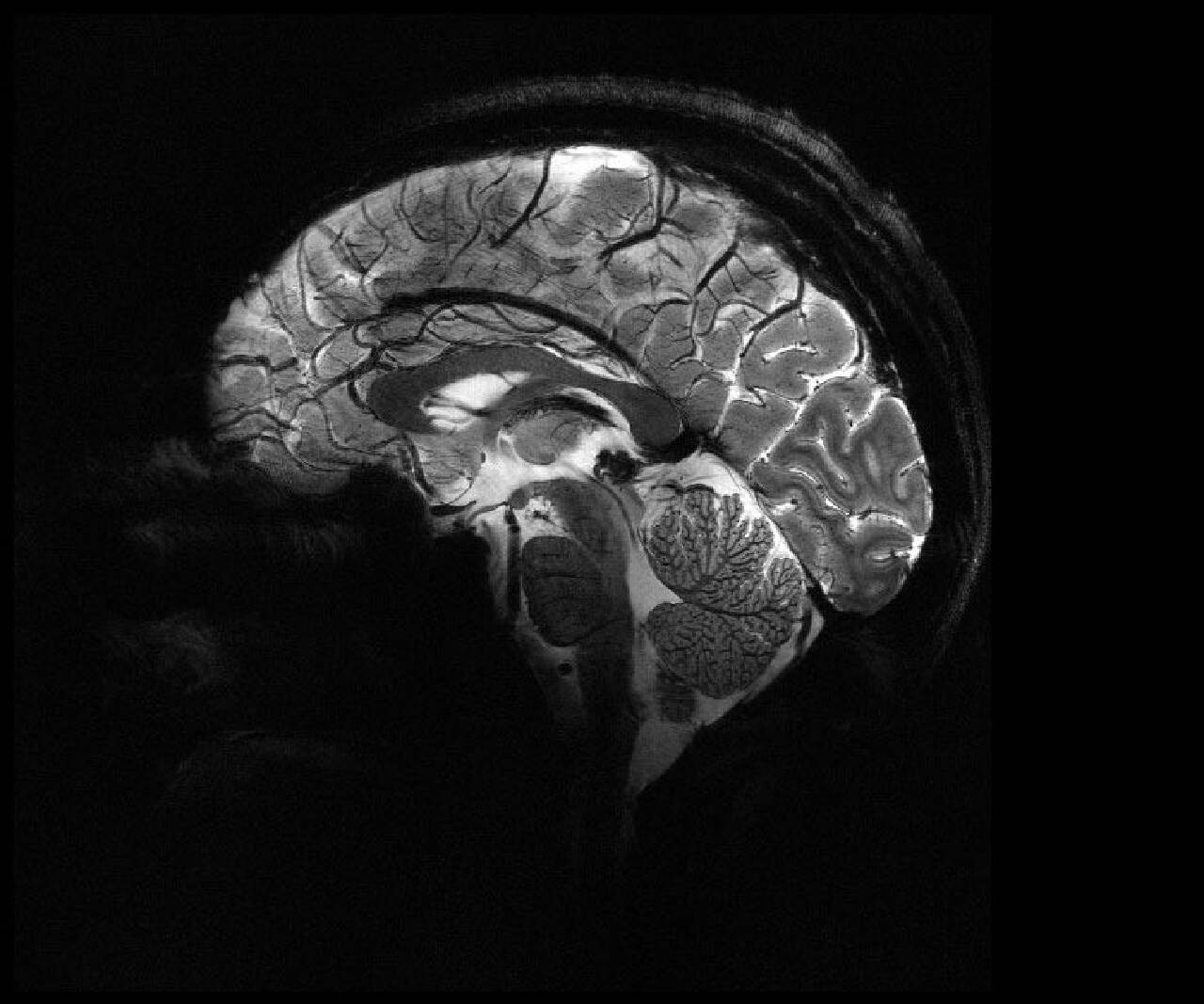 MRI cihazıyla çekilen insan beyninin en net görüntüsü yayınlandı