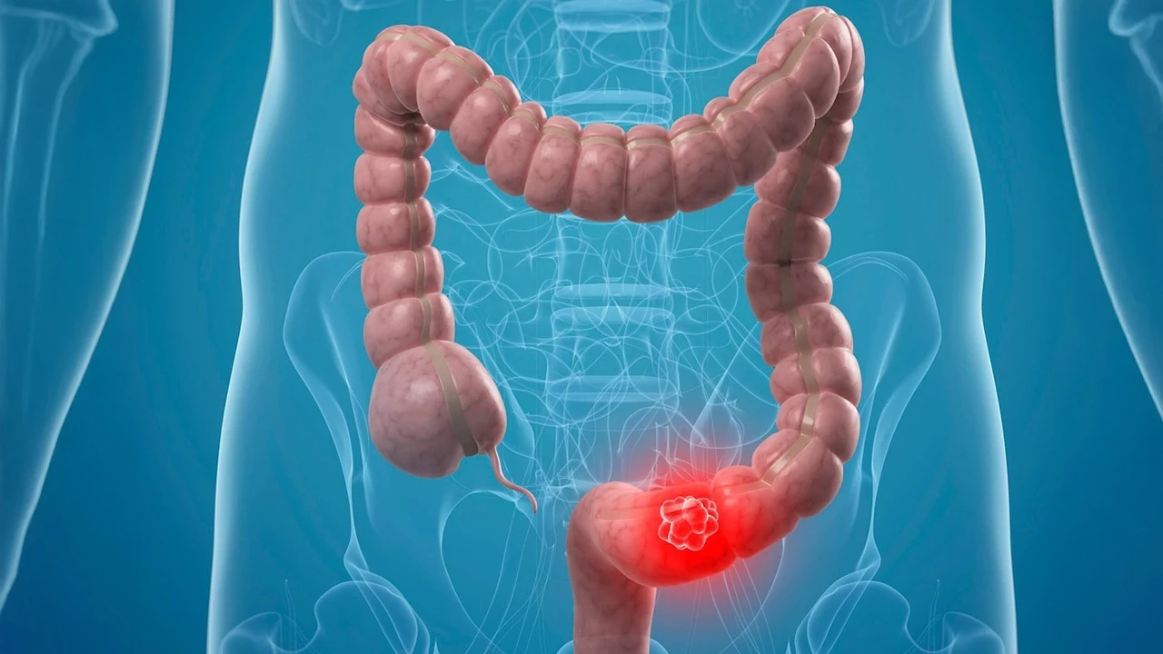 Kalın bağırsak kanserinden korunma yolları!