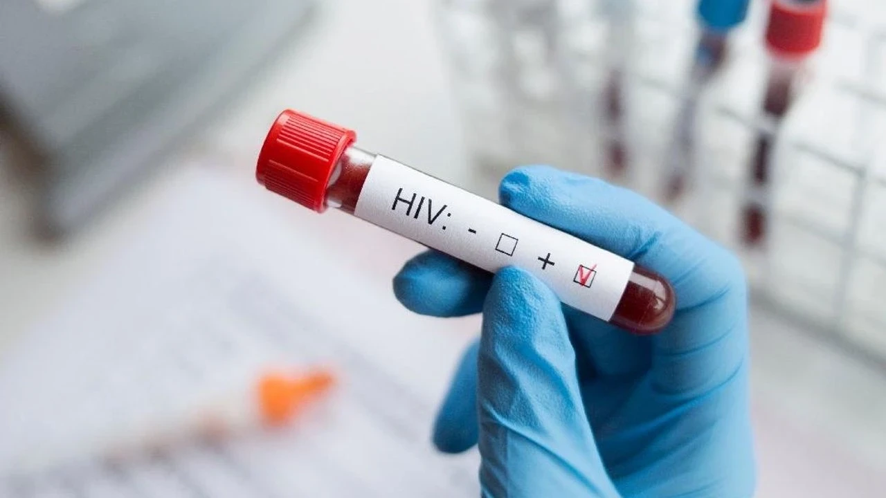 Eşinden HIV pozitif olduğunu saklayan kişiye 20 yıla kadar hapis cezası talebi istendi