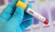 AIDS nedir? AIDS belirtileri nelerdir? HIV pozitif ne demek?