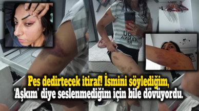 Pes dedirtecek itiraf! Aşkım demediğim için dövdü