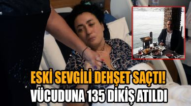 Eski sevgili dehşet saçtı: Vücuduna 135 dikiş atıldı!