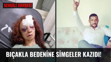 Sevgili vahşeti; Bıçakla bedenine simgeler kazıdı!