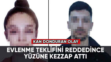 Kan donduran olay: Evlenme teklifini reddedince yüzüne kezzap attı