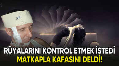 Rüyalarını kontrol etmek için matkapla kafasını deldi!