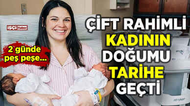 Çift rahimli kadının doğumu tarihe geçti: 2 günde peş peşe...