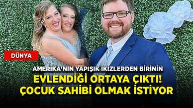 Amerika'nın yapışık ikizlerden birinin evlendiği ortaya çıktı! Çocuk sahibi olmak istiyor