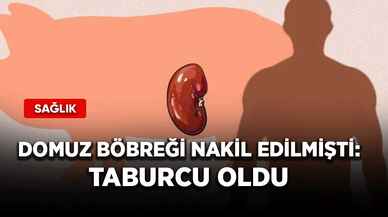 Domuz böbreği nakil edilmişti: Taburcu oldu