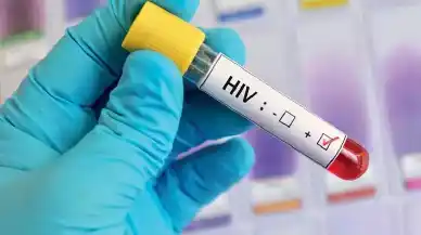 AIDS nedir? AIDS belirtileri nelerdir? HIV pozitif ne demek?