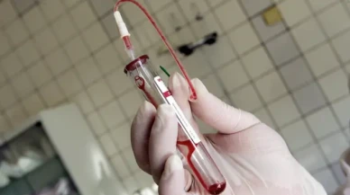 İzmir'de HIV nedeniyle ölen çocuğa ilişkin İl Sağlık Müdürlüğü'nden açıklama