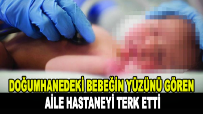 Doğumhanedeki bebeğin yüzünü gören aile hastaneyi terk etti