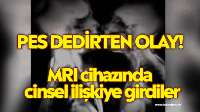 Pes dedirten olay! MRI cihazında cinsel ilişkiye girdiler