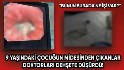 9 yaşındaki çocuğun bağırsaklarında öyle bir şey bulundu ki...