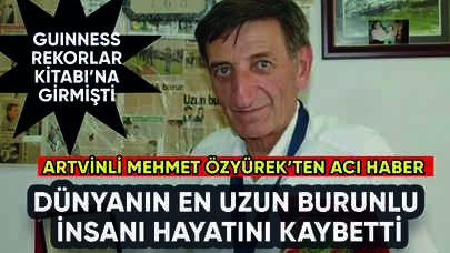 Dünyanın en uzun burunlu insanı Mehmet Özyürek'ten acı haber