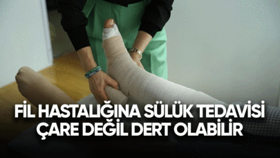 Fil hastalığında sülük tedavisi çare değil dert olabilir