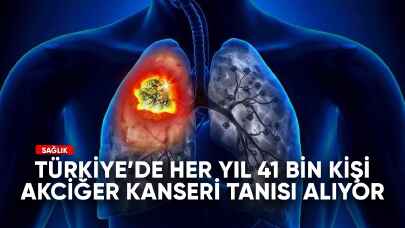 Türkiye'de her yıl 41 bin kişi akciğer kanseri tanısı alıyor