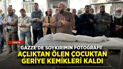 Gazze'de soykırımın fotoğrafı! Açlıktan ölen çocuktan geriye kemikleri kaldı