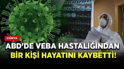 ABD'de veba hastalığından bir kişi hayatını kaybetti!