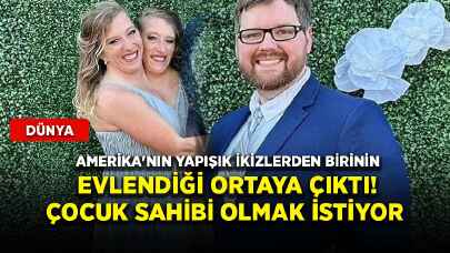 Amerika'nın yapışık ikizlerden birinin evlendiği ortaya çıktı! Çocuk sahibi olmak istiyor