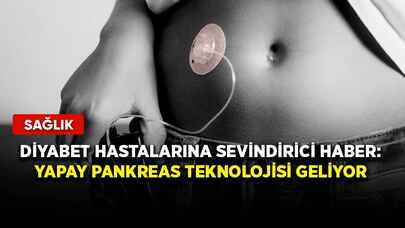 Diyabet hastalarına sevindirici haber: Yapay pankreas teknolojisi geliyor