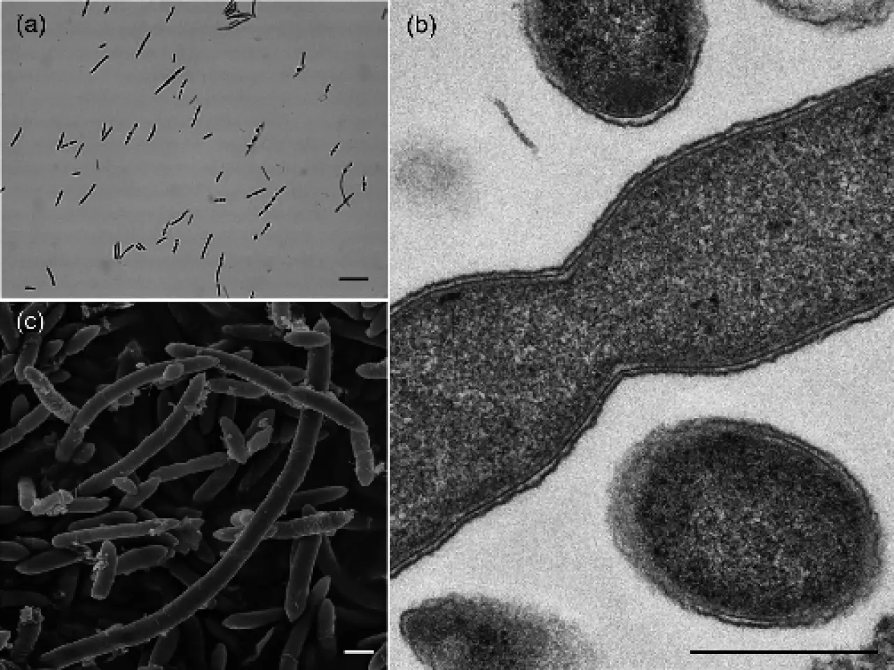 Lawsonibacter asaccharolyticus gen. nov., sp. nov., a butyrate-producing  bacterium isolated from human faeces | Microbiology Society