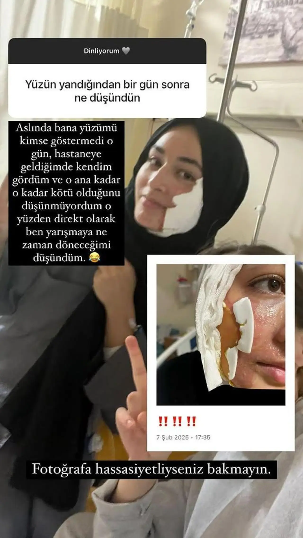 Masterchef Beyza yarışmaya ara vermişti Kaza sonrası ilk defa en net halini paylaştı